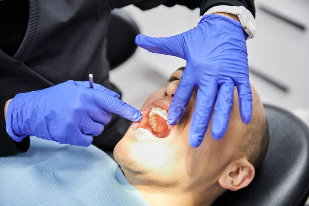 Best Root Canal Emergency Dentist  in Deshler, OH